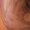 Burl